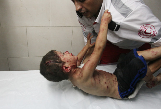 Palestinian medic tries to comfort a wounded boy at Shifa hospital in Gaza City, northern Gaza Strip,